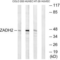 ZADH2 antibody