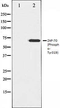 ZAP-70 (Phospho-Tyr319) antibody