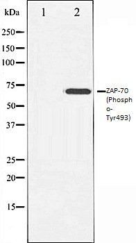 ZAP-70 (Phospho-Tyr493) antibody