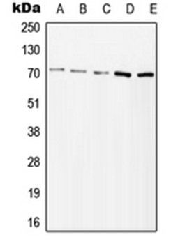ZAP70 (phospho-Y315) antibody
