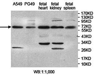 ZAP70 antibody