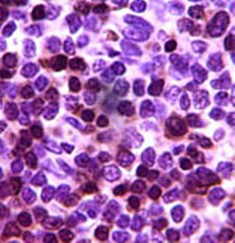 ZAP70 Antibody