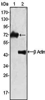 ZAP70 Antibody