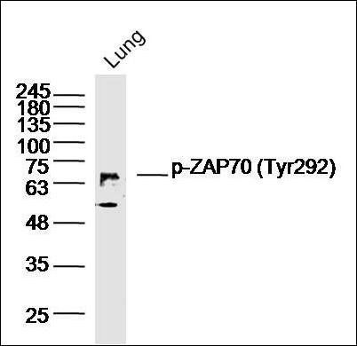 ZAP70 (Phospho-Tyr292) antibody