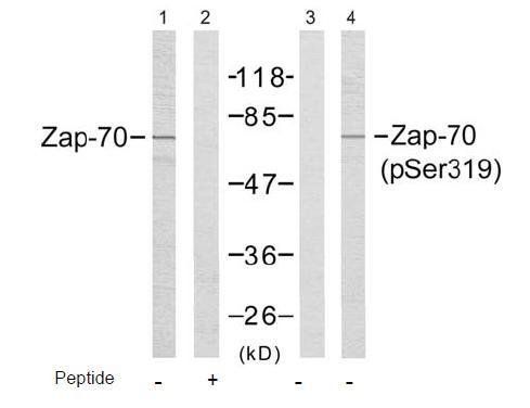 Zap-70 (Phospho-Tyr319) Antibody