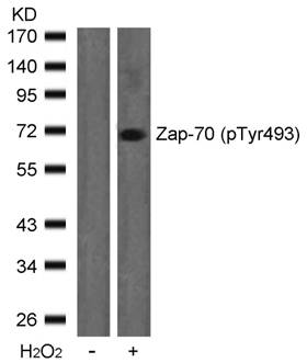 Zap-70 (Phospho-Tyr493) Antibody