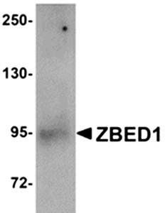 ZBED1 Antibody