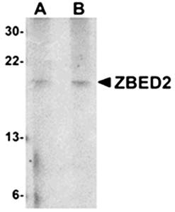 ZBED2 Antibody
