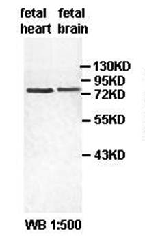 ZBED5 Rabbit Polyclonal Antibody