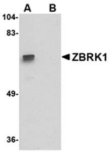 ZBRK1 Antibody