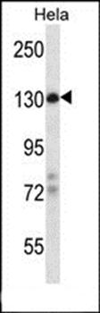ZBTB11 antibody