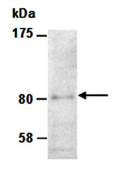 ZBTB16 antibody