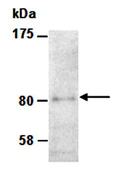 ZBTB16 (N) Antibody, Rabbit Polyclonal