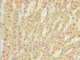 ZBTB20 Antibody