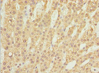 ZBTB20 antibody