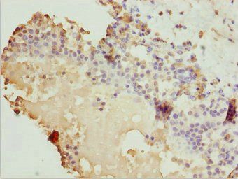 ZBTB20 Antibody