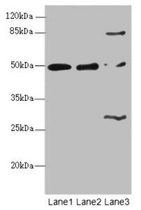 ZBTB25 Antibody