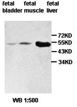 ZBTB25 Rabbit Polyclonal Antibody