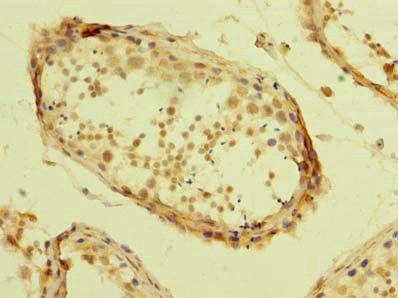 ZBTB32 antibody