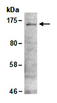 ZBTB38 (C) Antibody, Rabbit Polyclonal
