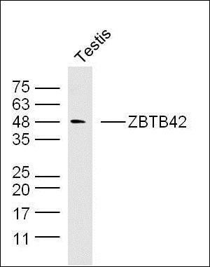 ZBTB42 antibody