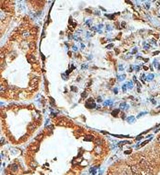 ZBTB42 Rabbit Polyclonal Antibody