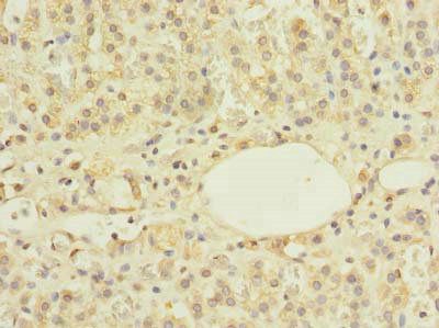 ZBTB43 Antibody