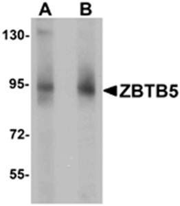 ZBTB5 Antibody