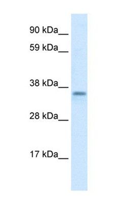 ZC2HC1A antibody