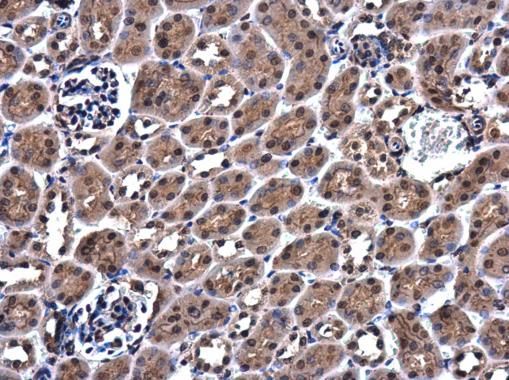 ZC3H12A Rabbit Polyclonal Antibody