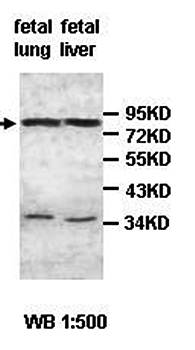 ZC3H12B antibody