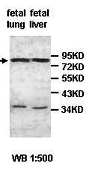 ZC3H12B Rabbit Polyclonal Antibody