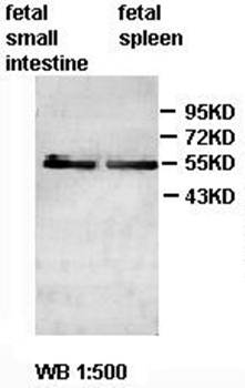 ZC3H12D antibody