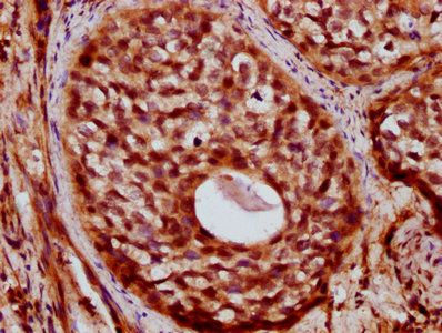 ZC3H14 Antibody