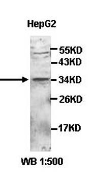 ZC3H14 Rabbit Polyclonal Antibody