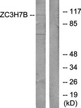 ZC3H7B antibody