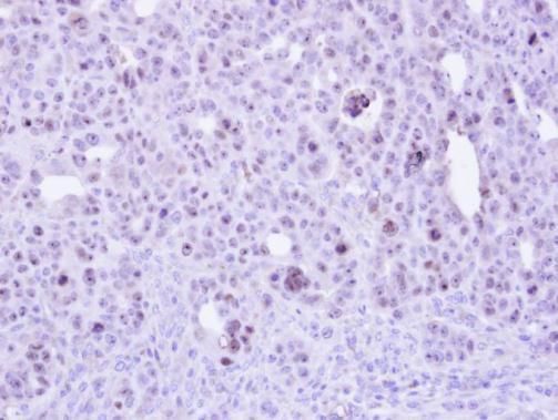 ZC3H8 Rabbit Polyclonal Antibody