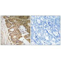 ZC3H8 Antibody