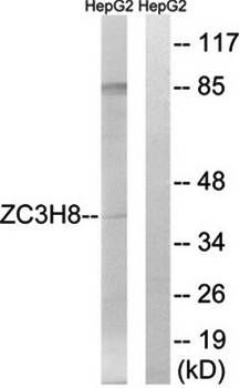 ZC3H8 Antibody