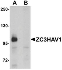 ZC3HAV1 Antibody