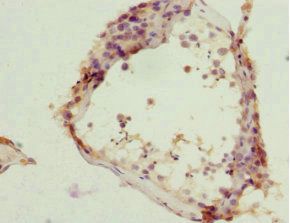 ZC3HC1 Antibody