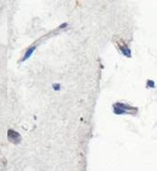 ZCCHC12 antibody