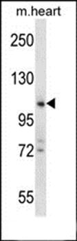ZCCHC14 antibody