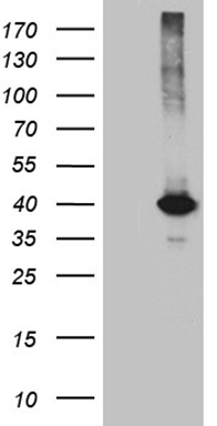 ZCCHC17 antibody