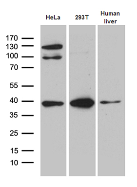 ZCCHC17 antibody