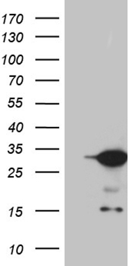 ZCCHC17 Antibody