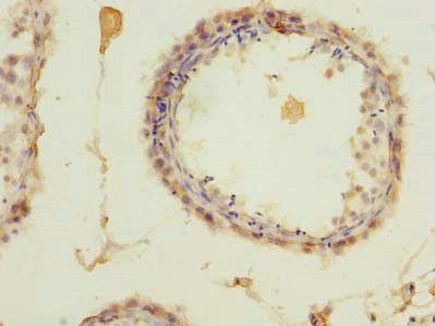 ZCCHC4 Antibody