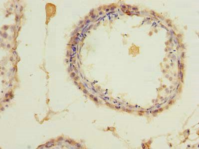 ZCCHC4 antibody