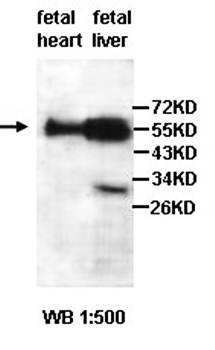 ZCCHC4 Rabbit Polyclonal Antibody