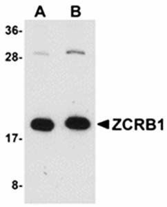 ZCRB1 Antibody